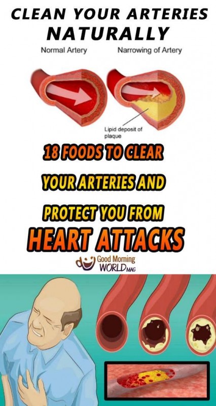 18 Foods to Clear Your Arteries and Protect You from Heart Attacks