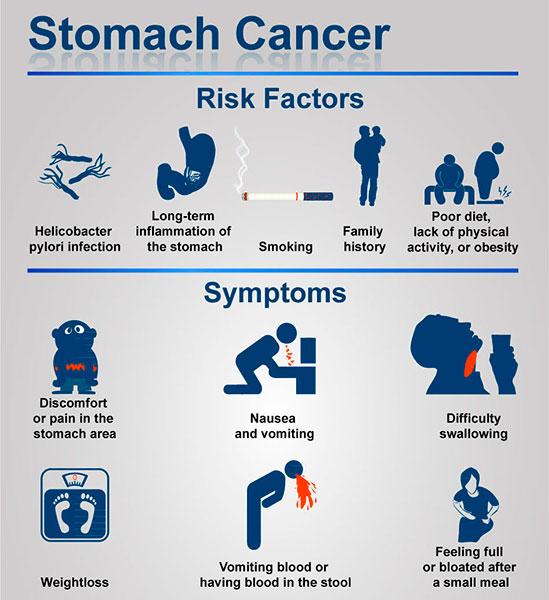 6 Warning Signs of Stomach Cancer