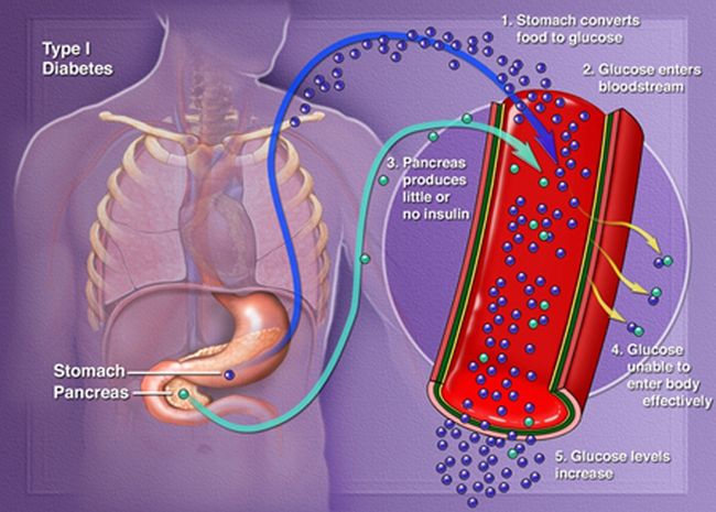 7 Foods That Control Blood Sugar