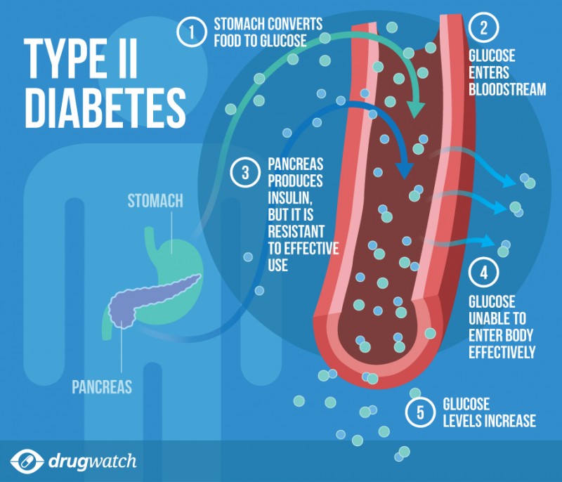 Diabetes: The Differences Between Types 1 And 2