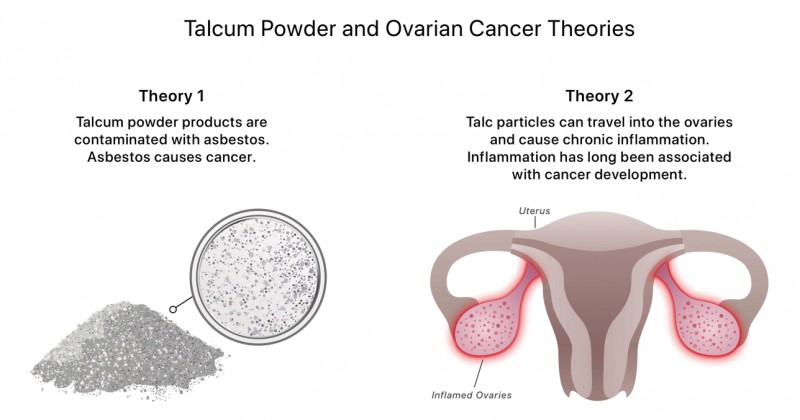 Does Baby Powder Cause Cancer? What To Know