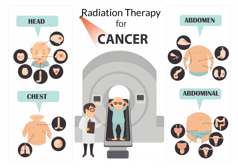 New Cancer Drug Safely Boosts Radiation Therapy