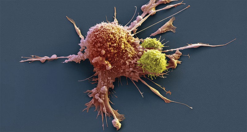 New Way To Manipulate Immune Cells May Treat Cancer, Autoimmune Disease