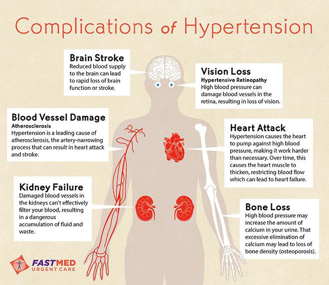 What Is Hypertension?