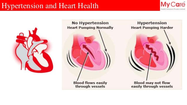 What Is Hypertension?