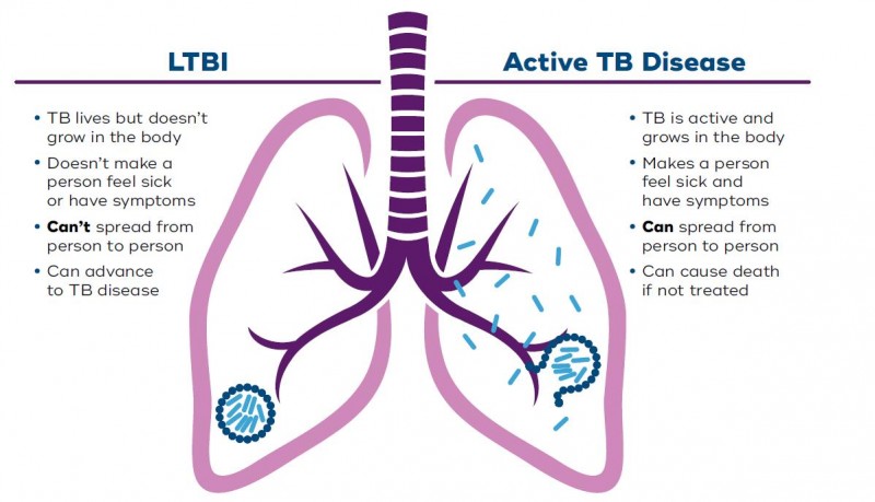 What Is Tuberculosis?